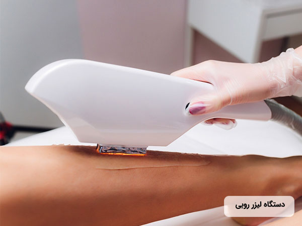 رفلزدودن موهاي زائد پا با استفاده از دستگاه ليزر روبي