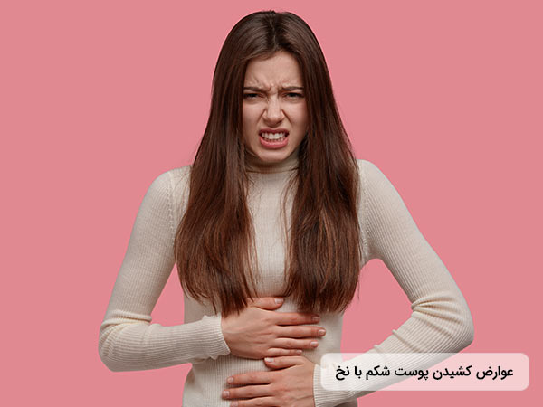 خانم جواني از عوارض ليفت شکم با نخ دارد رنج مي برد
