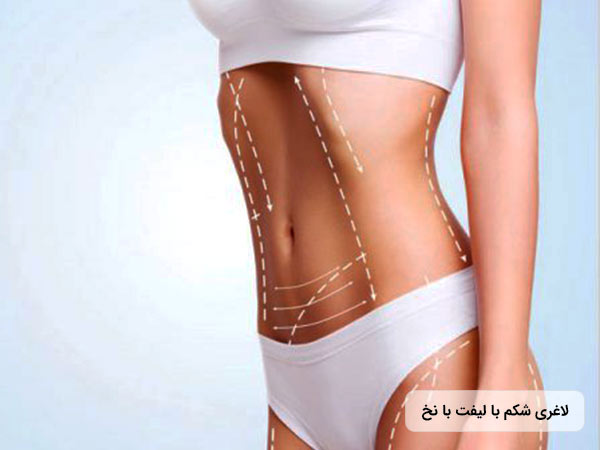 خانمي ابدومينوپلاستي انجام داده است و شکم صاف وخوش فرمي دارد.