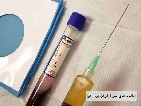تصویری از سوزن و ماده تزریقی پی آر پی به ههمراه اجزای دیگر این عمل