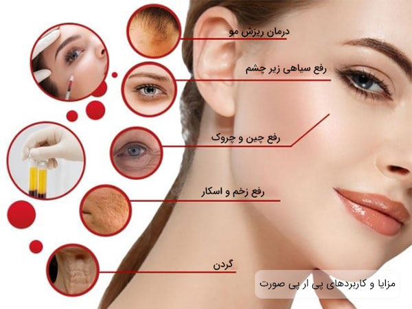 تصویر مزایا و کاربردهای پی ار پی برای صوت با زمینه سفید در صورت ک دختر خانم مشخص و مشهود می باشد