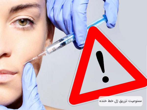 ممنوعت تزریق ژل برای رفع خط خنده در تصویر کاملا مشخص می باشد