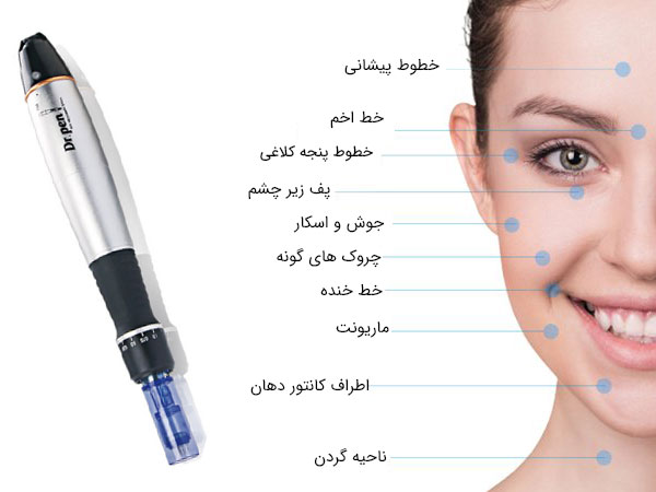 اهمیت و موارد استفاده از دستگاه درماپن برای زیباسازی و جوانسازی صورت در تصویر با صورت یک خانم و زمینه سفید کاملا نمایان می باشد
