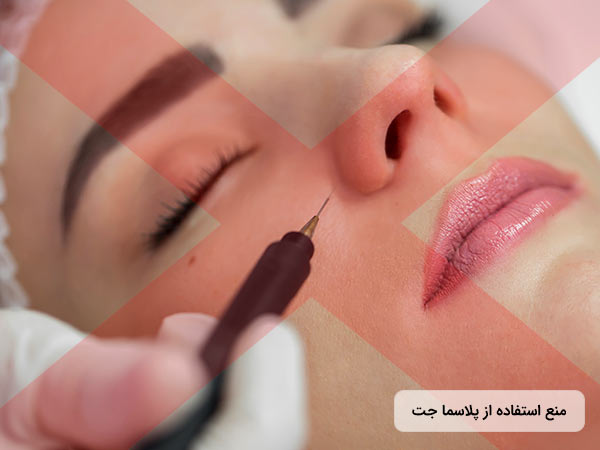 يک خانم روي تخت خوابيده است و دکتر در حال زيباسازي پوست او با استفاده از روش بلفاروپلاستي ديناميک مي باشد