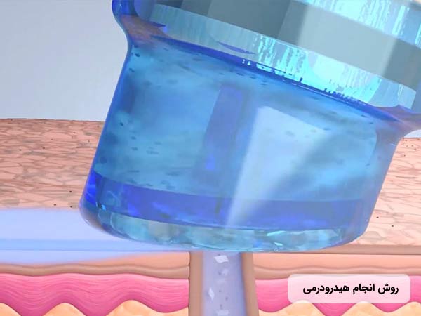 اثرگذاري دستگاه هيدرودرم بر روي پوست