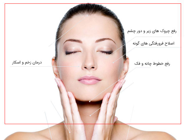 موارد استفاده از پی ار پی در رفع مشکلات صورت به تصویر کشیده شده است . زمینه تصویر سفید می باشد
