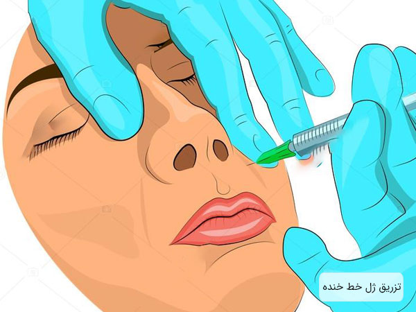 "نحوه