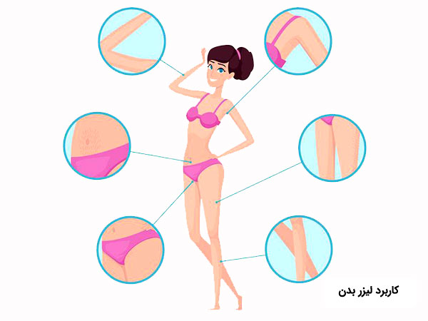 قسمت هاي مختلف قابل استفاده از موهاي زائد بدن