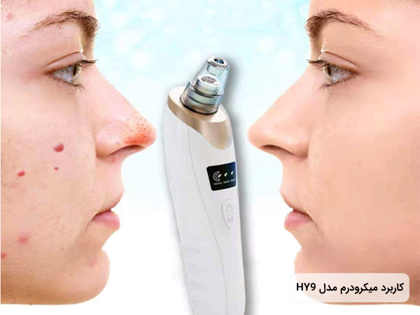 کاربرد دستگاه ميکرودرم خانگي مدل HY9