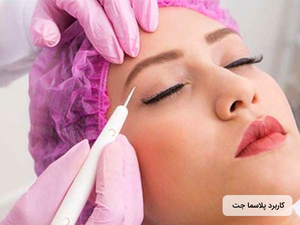 خانم جواني روي تخت خوابيده و کلاه مخصوصي به سر کرده است. پزشک با استفاده از قلم پلاسما جت در حال جوانسازي پوست صورت خانم مي باشد