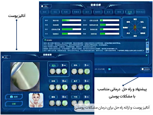 آنالیز و ارائه درمان پوست در دستگاه فیشیال اسمارت آیس بلو