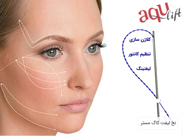 خرید نخ لیفت کاگ مستر آکوا لیفت برای سفارش خرید و قیمت نخ لیفت کاگ