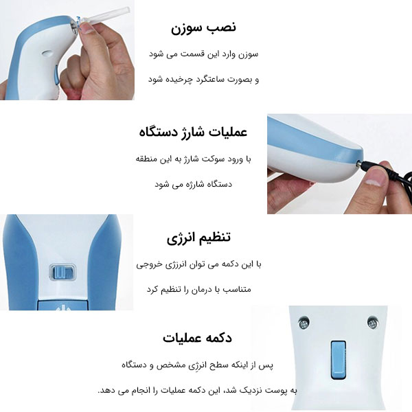 اجزای مختلف پلاسماپن مگلو مورد بررسی قرار گرفته است .