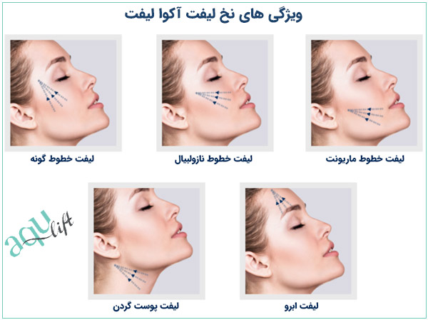 ویژگی های نخ آکوالیفت برای کشیدن اجزای مختلف صورت