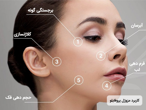 قيمت مزوژل پروفايلو اصل ايتاليا برای جوانسازی به همراه تصویر خانم جوان