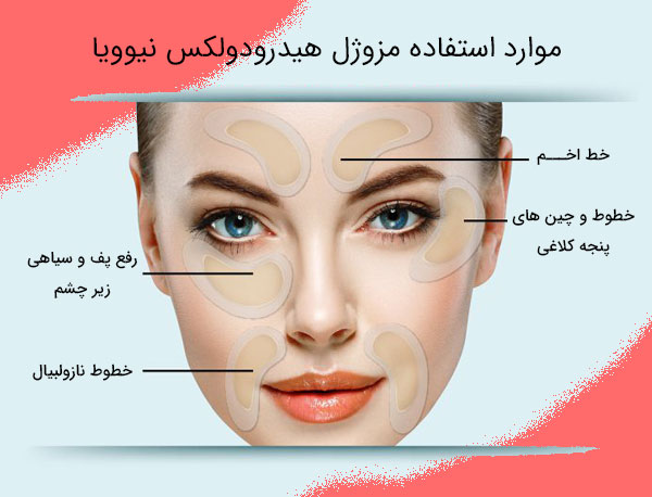 تصویری از کاربردهای مزوژل نیوویا هیدرودولوکس