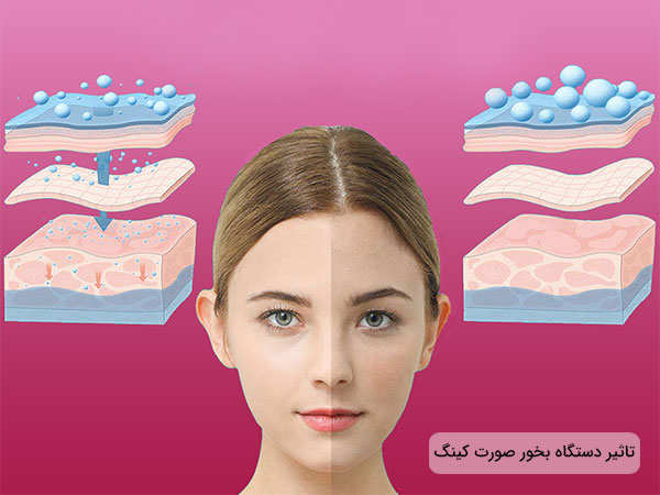 تاثیر دستگاه بخور صورت خانگی کینگا در تصویر مشخص می باشد.