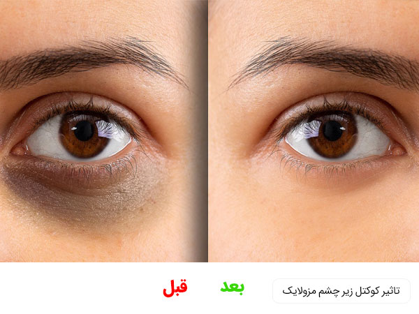 خرید کوکتل زیرچشم مزولایک با بهترین قیمت