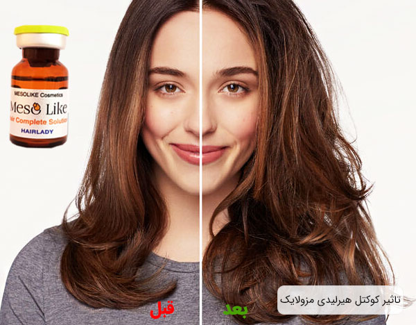 مزو هیرلیدی مزولایک اسپانیا با بهترین قیمت و بالاترین کیفیت تاثیر مزولایک هیرلیدی