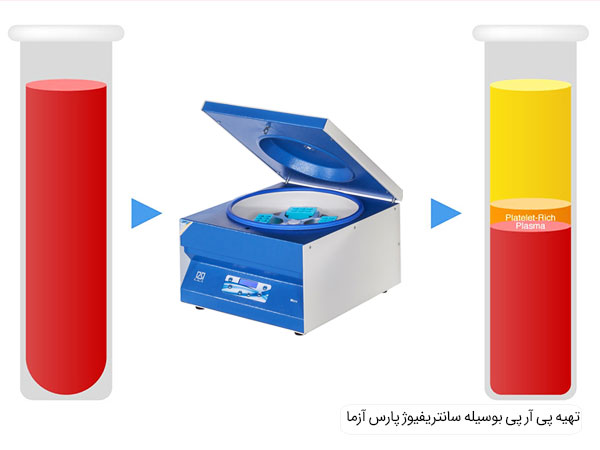 خرید سانتریفیوژ پی آر پی پارس آزما