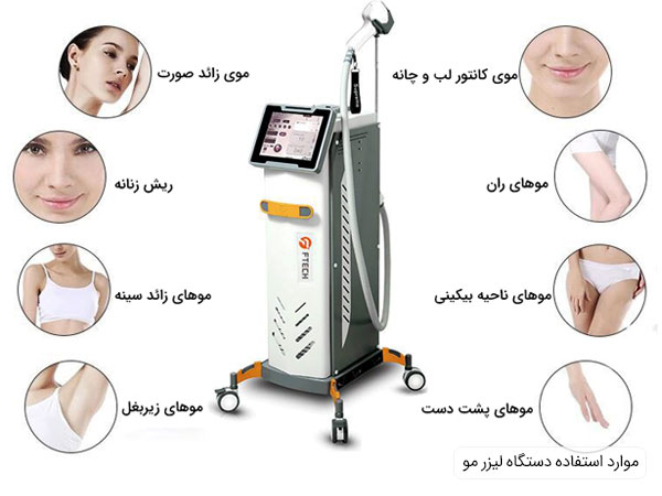 موارد استفاده از دستگاه لیزر مو Ftec ساخت کشور چین تحت لیسانس کره جنوبی