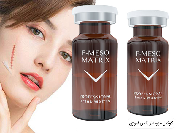 مزو ضد خطوط نیمه عمیق تر اسناده