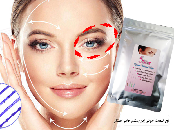 نخ لیفت 5 استار مونو زیر چشم