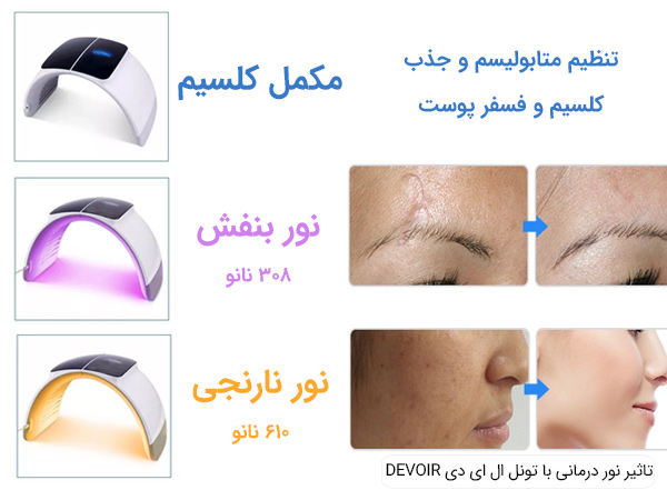 اثرگذاری استفاده از تونل ال ای دی DEVOIR