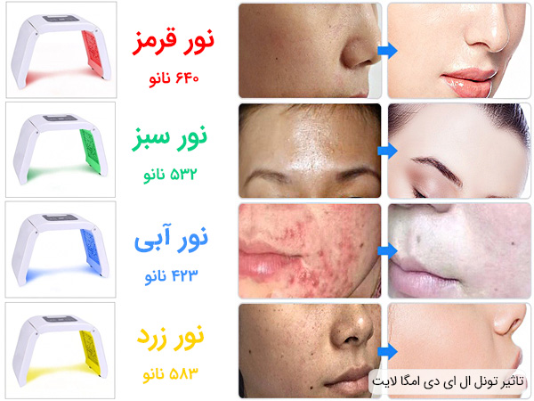 تاثیر استفاده از تونل ال ای دی امگا لایت 4 رنگ