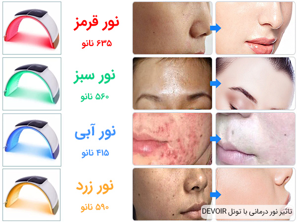 تاثیر استفاده از تونل ال ای دی DEVOIR