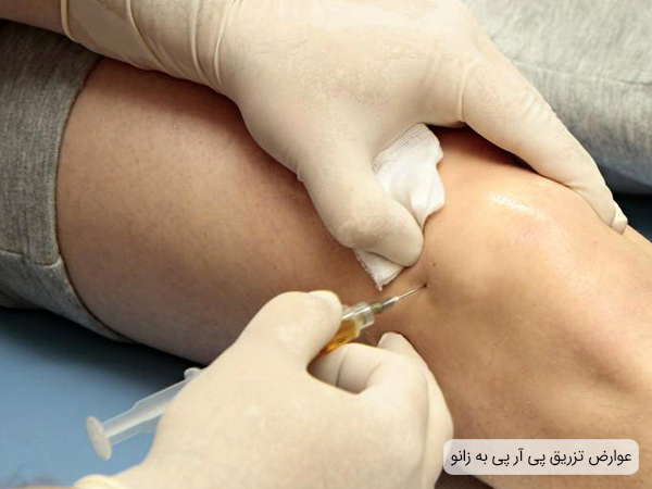 عوارض تزریق پی آر پی به مفاصل