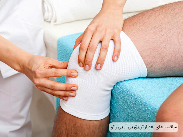 مراقبت های تزریق پی آر پی به مفاصل در تصویر نمایان است