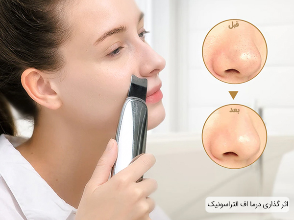 قیمت درما اف التراسونیک