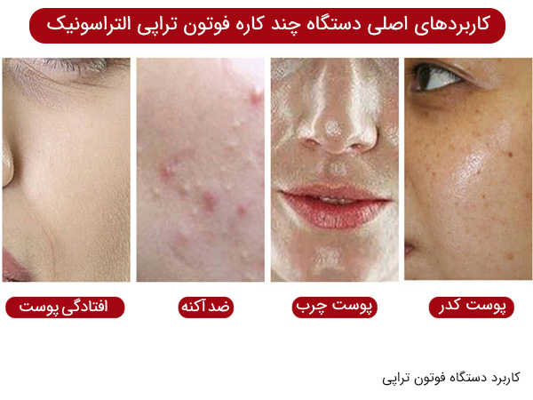 اثرات دستگاه فوتون تراپی