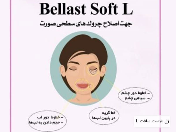 موارد مصرف فيلر Soft L Bellast