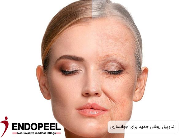 تصويري از يک صورت در دوحالت مختلف پير و جوان.