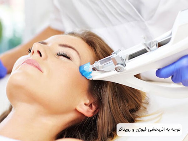 میزان اثربخشی؛ فاکتوری برای مقایسه کوکتل فیوژن و رویتاکر