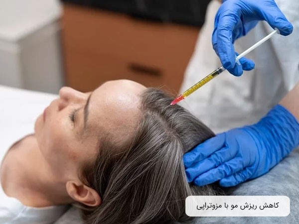 مزوتراپی برای درمان ریزش مو