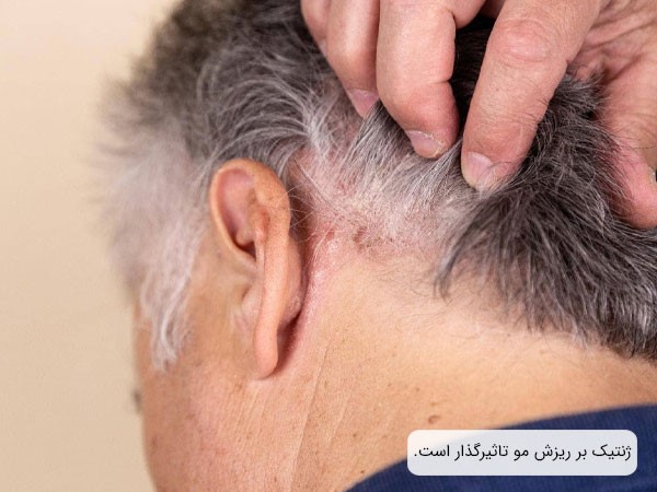 ژنتیک، سن و وضعیت عمومی فرد؛ عواملی موثر بر اثربخشی مزوتراپی مو