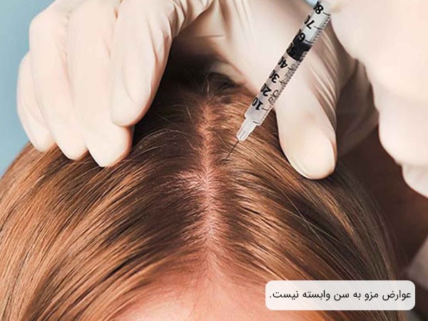 سن مراجعهکننده؛ فاکتوری بیتاثیر در عوارض مزوتراپی مو