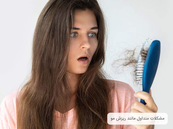 يک خانم با شانه در دست که متوجه ريزش مو هاي خود شده است.