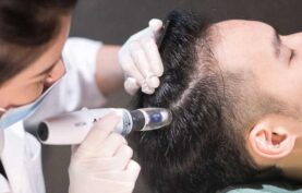 انجام مزوتراپی روی موی سر يک آقا توسط متخصص