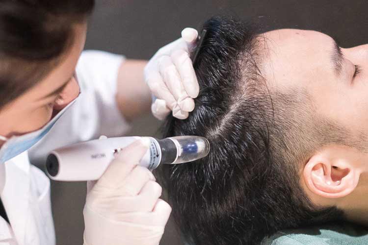 انجام مزوتراپی روی موی سر يک آقا توسط متخصص