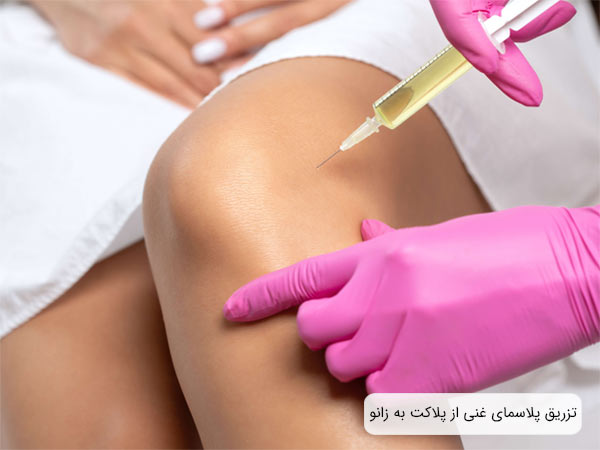 تزريق يک سرنگ حاوی پی آر پی به زانوی يک خانم توسط متخصص.
