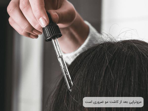 استفاده از کوکتل مزوتراپی روی سر يک خانم.