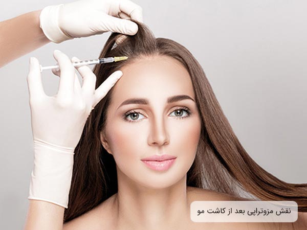 تزريق کوکتل مزوتراپی به سر يک خانم توسط پزشک.
