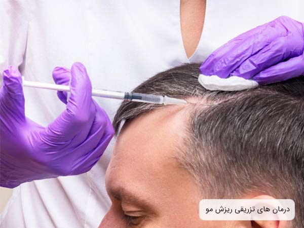 تزريق داروری ريزش مو به سر يک آقا توسط متخصص.