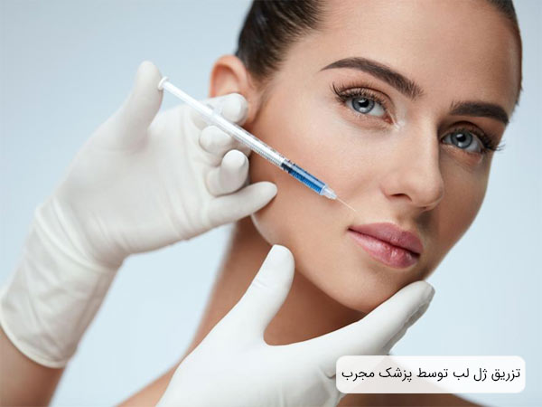 تزريق فيلر به لب يک خانم توسط پزشک متخصص.