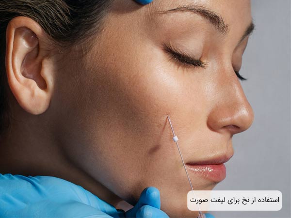 استفاده از نخ ليفت بر روی صورت يک خانم.