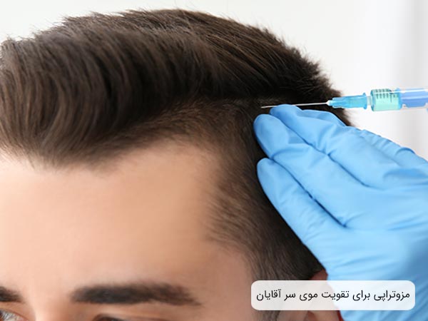 انجام عمل کاشت مو توسط دو پزشک بر روی سر يک آقا.